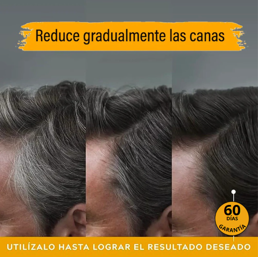 ¡Champú Tapa Canas, Negro Por Meses! + ¡ENVÍO GRATIS POR CYBERNAVIDAD! 😱✨